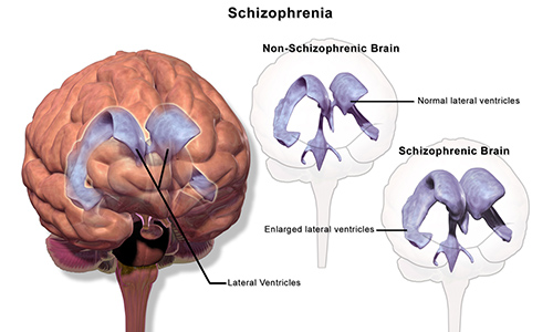 types of mental health disorders