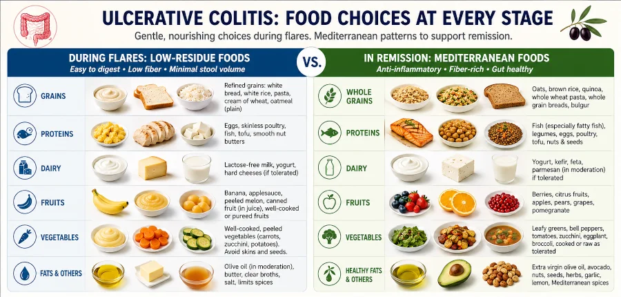 Comparison chart showing low-residue foods for ulcerative colitis flares versus Mediterranean foods for remission.