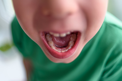 child opening mouth showing healthy teeth