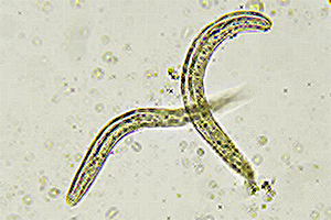 Pinworms