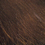 someones hair filled with tiny dandruff flakes