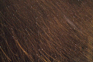 someones hair filled with tiny dandruff flakes