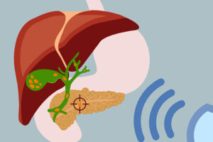 gallbladder and surrounded organs