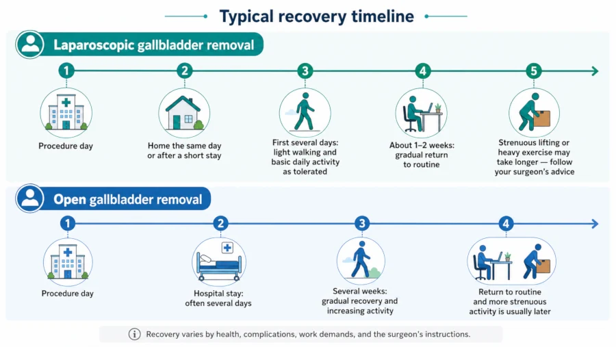Timeline comparing recovery after laparoscopic and open gallbladder removal.