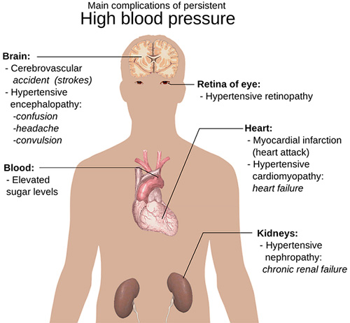 main complications of persistent high blood pressure