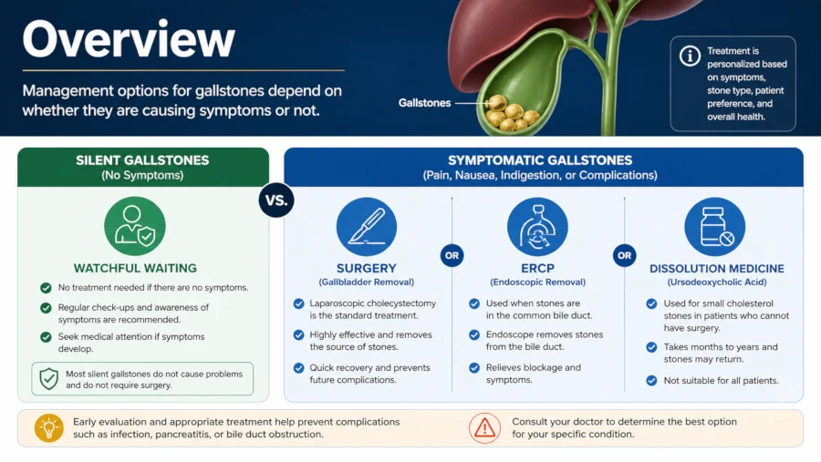 Overview showing watchful waiting for silent stones and surgery, ERCP or dissolution medicine for symptomatic gallstones.