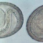 two intestinal parasites