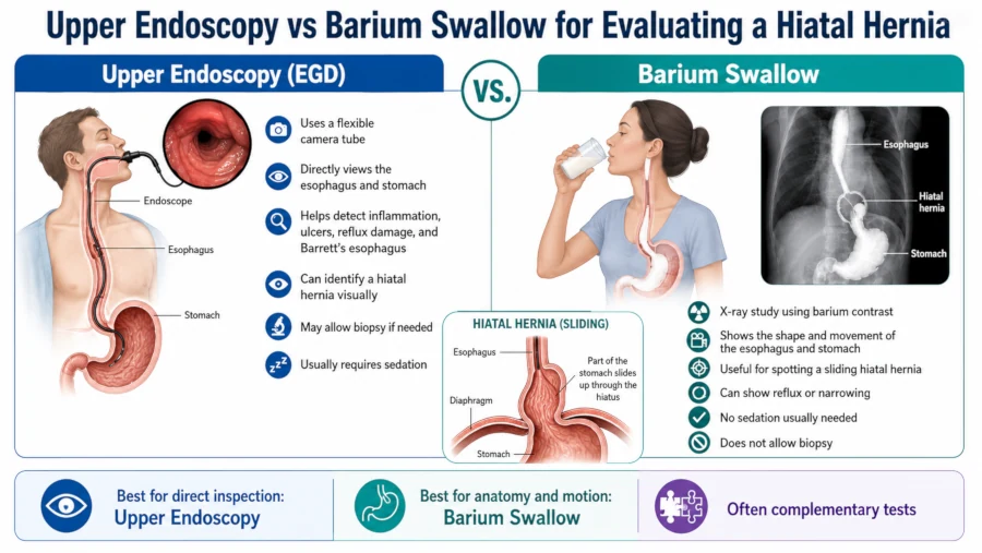 Comparison of upper endoscopy and a barium swallow for evaluating a hiatal hernia