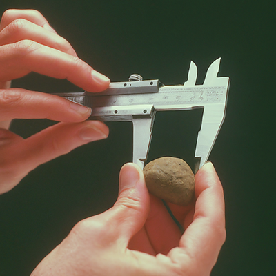 Someone measuring a gallstone with a tool