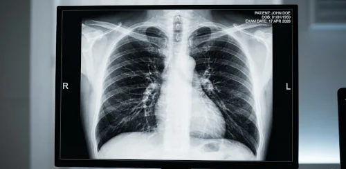 Chest imaging scan used to evaluate heart and lung conditions.